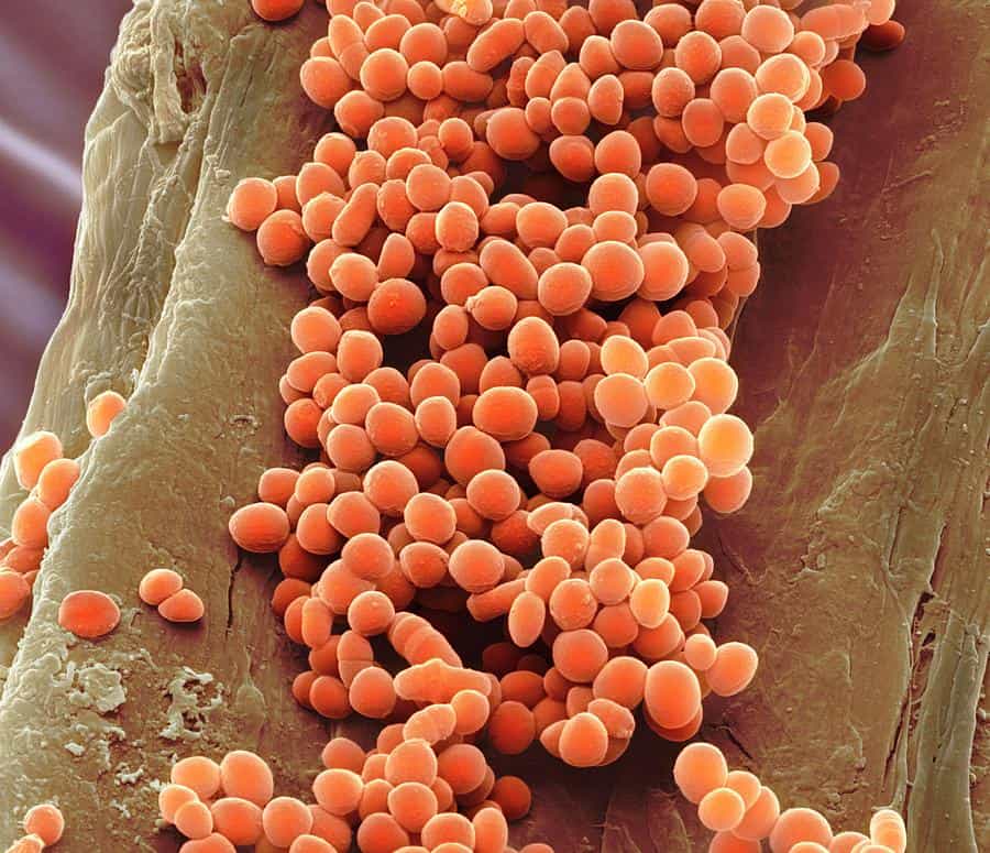 Lactococcus lactis